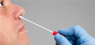 Get a test kit delivered straight to your. Sars Cov 2 Nicht Nur Im Nasopharynx Zuverlassig Nachweisbar