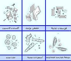 غثيان معكرونة شريحة وجود مخاط في البول عند الرجال findlocal drivewayrepair com