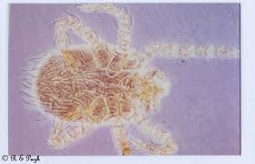 Image result for Trombicula autumnalis