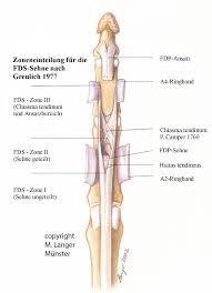 They run down the forearm and within the carpal tunnel. Pdf Zones Of Flexor Digitorum Superficialis Tendon Invented By Greulich