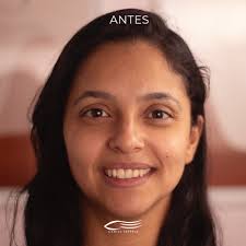 Alongamento de cílios fio a fio, bem cheinho, bem maravilhoso 💕❤️ Agende o  seu pelo 11 986915099 Estamos em Suzano, Rua Tiradentes 175 Sala 2, Suzano.  #cíliosfioafio #alongamentodecilios #extensaodeciliosfioafio #olhar  #Micropigmentação #love #