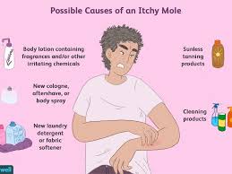 This webmd slideshow tells you how to spot the early warning signs of skin cancer and seek treatment. What Could Cause An Itchy Mole