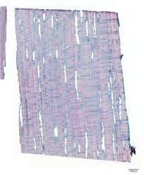 Image result for Dalbergia boehmii