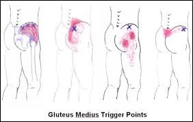 lower back pain trigger points