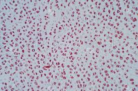 To the left is muscle tissue, and to the right is bone marrow. Cross Section Human Cartilage Bone Under Microscope View For Education Histology Human Tissue Stock Photo Picture And Royalty Free Image Image 104344176