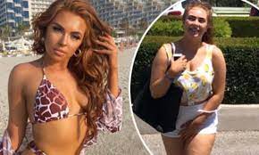 Demi jones has revealed she has been diagnosed with thyroid cancer following the removal of a lump last month. Love Island S Demi Jones Showcases Three Stone Weight Loss Daily Mail Online