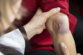 Image result for Difficult Intravenous Access in Children