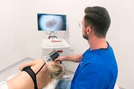 Wideodermatoskopia - co to - zdjęcie 1