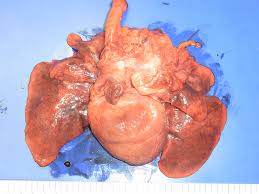 Image result for Chemodectoma