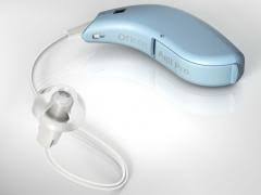 Koristi kod osoba koje imaju do 30% oštećenja sluha. Widex Slusni Aparati Mali Oglasi I Prodavnice Goglasi Com