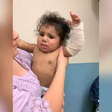 State Investigating Battle Ground Daycare After Baby Badly Burned Local News Kptv Com