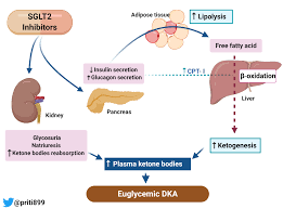 Here's a quick outline of the pathophysiology of dka, in simple steps for you to follow (you won't find these steps in your textbook, i put it together this way to make learning it easier for you!): Sglt2 Inhibitor Induced Euglycemic Diabetic Ketoacidosis Renal Fellow Network