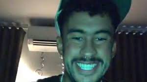 My two front teeth are larger than my lateral incisors.giving the appearance of 'bunny' teeth. Petition We Want Bad Bunny To Release The Song With Zion Y Lennox Change Org