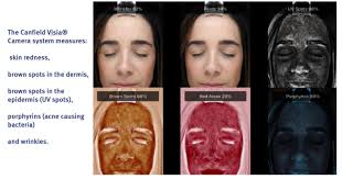 Why Our Skin Type Quiz Is Best