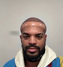 asked for a transplant & they turned him to squidward 😭