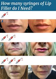 Restylane can be used on all skin types and colours. How Many Syringes Of Filler Do I Need Reflections Center