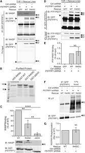 Today's comics, crossword puzzles and games from seattle pi. The F Bar Protein Pstpip1 Controls Extracellular Matrix Degradation And Filopodia Formation In Macrophages Sciencedirect