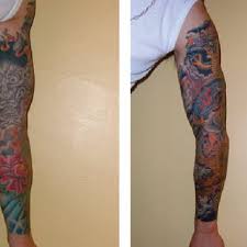 Now grade a tattoo offers laser tattoo removal services. A The First Freedom 2 Tattoo Is Being Placed In The Arm Of The Ceo Of Download Scientific Diagram