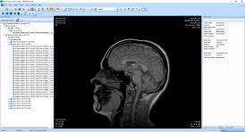 Check spelling or type a new query. Overview Microdicom Dicom Viewer