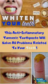 Because they contain low concentrations of carbamide peroxide or natural teeth whitening methods to avoid. Pin On Teeth Treatments
