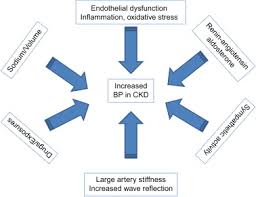 Acute renal failure occurs in 5 percent of hospitalized patients. Pathophysiology Of Hypertension In Chronic Kidney Disease Sciencedirect