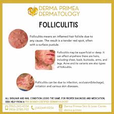 Image result for Deep Folliculitis
