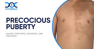 Image result for Precocious Puberty