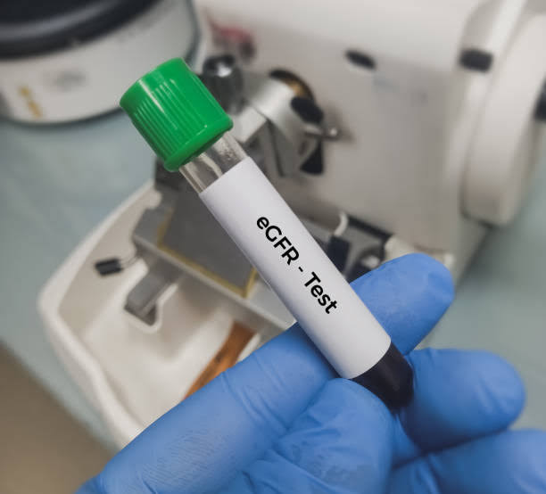 EGFR product image