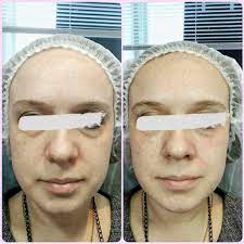 Чего же мы ожидаем, когда желанный эффект получен?