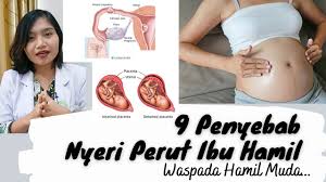 Check spelling or type a new query. 9 Penyebab Nyeri Perut Pada Ibu Hamil Waspada Hamil Muda Dr Emasuperr Youtube