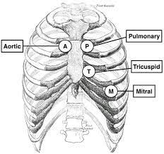 Regular rhythm, soft systolic murmur, no added sounds (auscultation of heart) forceful apical beat (palpation of the heart) normal carotid upstrokes (palpation of carotid) 2+ femoral and radial pulses (examination of peripheral arteries) 1+ bilateral pitting edema (exam of periphery cardiovascular) Thorax Diagram With All Cardiac Auscultation Sites Marked Image Download Scientific Diagram