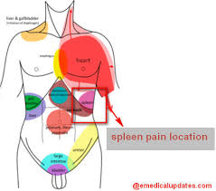 A common symptom of an enlarged spleen is a feeling of pain or discomfort in the upper left side of abdomen, where the spleen is located. Spleen Pain Location Function Enlarged And Ruptured Spleen