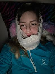 Having jaw surgery early November and mouth will be wired shut for several  weeks. I'll be able to drink liquids through a straw or condiment bottle  and will appreciate any broth or