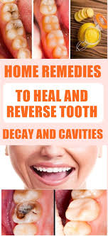 Home Remedies To Heal And Reverse Tooth Decay And Cavities Green Holistic Tips Tooth Decay Remedies Tooth Decay Natural Oral Care