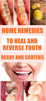 This web page explains how the tooth decay process starts and how it can be stopped or even reversed to keep your child from getting cavities. How To Reverse Cavities And Heal Tooth Decay Arxiusarquitectura