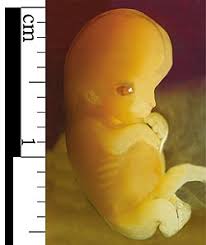 Fertilisasi adalah pembuahan yaitu suatu proses peleburan atau juga fusi dari gamet gamet haploid, berupa sel sperma dari laki laki dan juga sel ovum atau sel telur dari perempuan yang sudah matang. Embrio Wikipedia Bahasa Indonesia Ensiklopedia Bebas