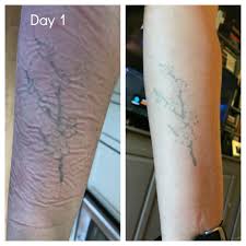 Both of these claims are patently false. How Well Do Inkbox Semi Permanent Tattoos Work We Put Them To The Test