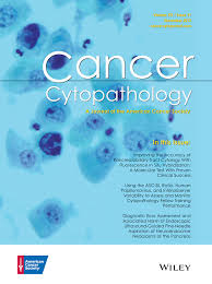 Patients with merkel cell carcinoma are usually. The Merkel Cell Carcinoma Challenge Pantanowitz 2013 Cancer Cytopathology Wiley Online Library