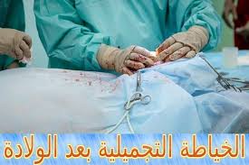 الخياطة التجميلية بعد الولادة متى تكون ضرورية Plastic Surgery Surgery