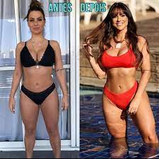 Ela compartilhou no instagram todo o processo de alongamento de fios e mostrou o quanto ficouu diferente do visual anterior. Carol Dias Mostra Antes E Depois Do Corpo Fiquei Melhor Pra Mim Quem Quem News