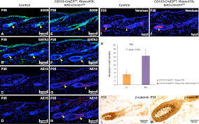 The parthenon intracrine sex steroid synthesis and signaling in human epidermal keratinocytes and dermal thus, the use of the complex contributed to the transition of follicles from the resting stage to the growth stage. Plos One Activation Of B Catenin Signaling In Cd133 Positive Dermal Papilla Cells Drives Postnatal Hair Growth