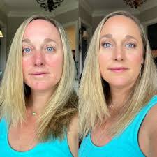 Seint makeup for rosacea and unevenness
