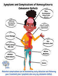 Image result for Homocystinuria