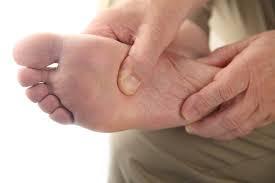 Penyakit kencing manis ataupun (dm = diabetis melitus; Ketahui Cara Perawatan Kaki Diabetes Yang Benar Alodokter
