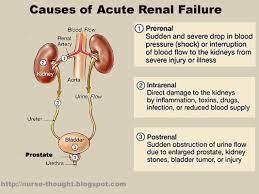 Periodic dialysis in terminal uremia, j. Acute Kidney Failure Acute Renal Failure Renal Failure Chronic Renal Failure