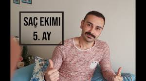 Sac Ekimi 5 Ay Youtube