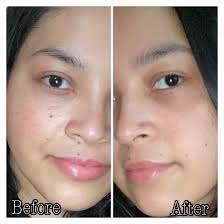 THE VIRAL REGENPEN™