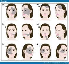 البهاق انواع متعددة وأسباب مجهولة بشرتي دوت كوم