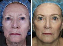 Ageless Skin Rejuvenation Med-Spa
