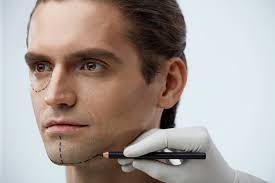 Il exerce depuis plus de. Chirurgie Esthetique Chez L Homme Dr Lasserre Chirurgien Esthetique A Lyon Villeurbanne